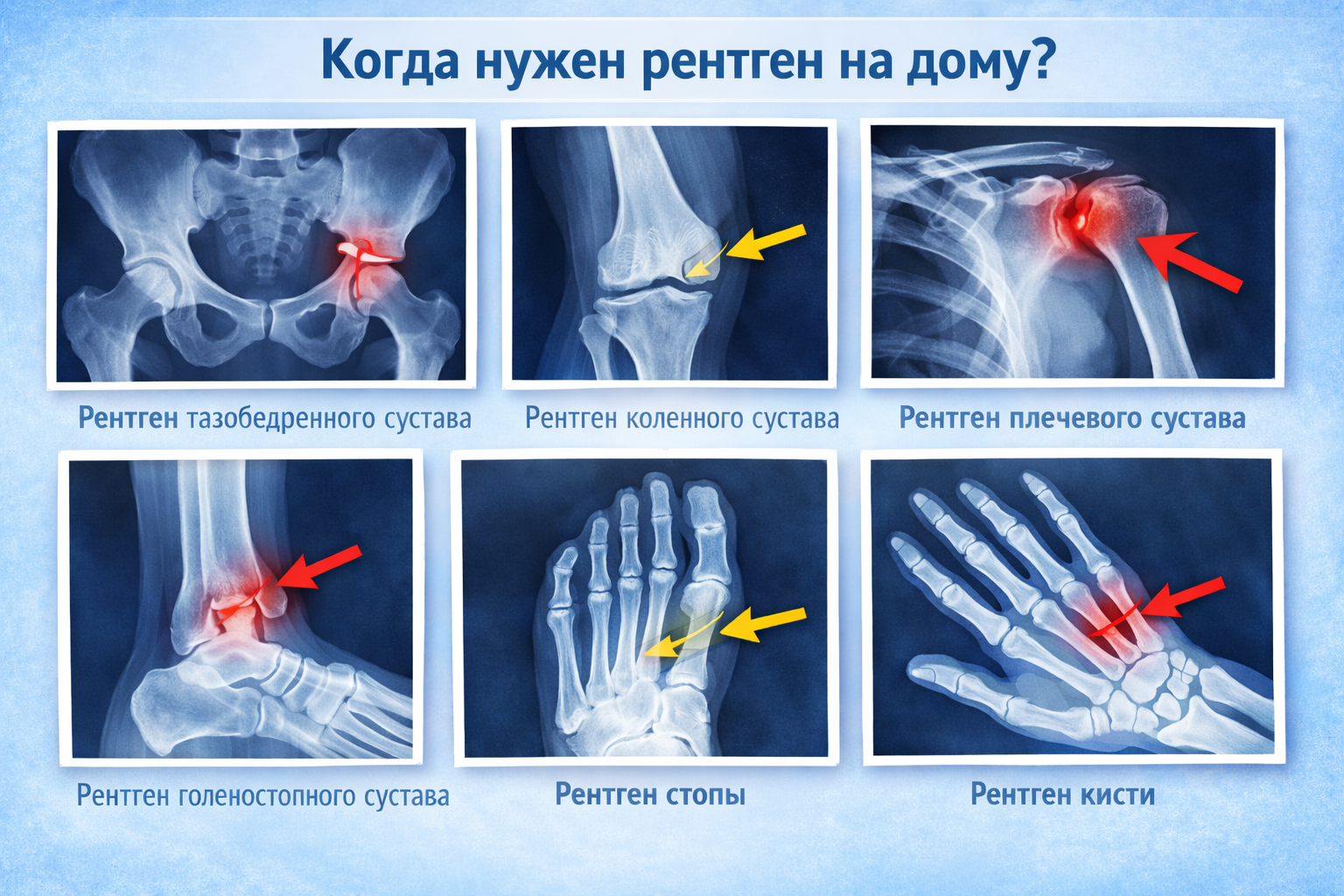 Рентген на дому